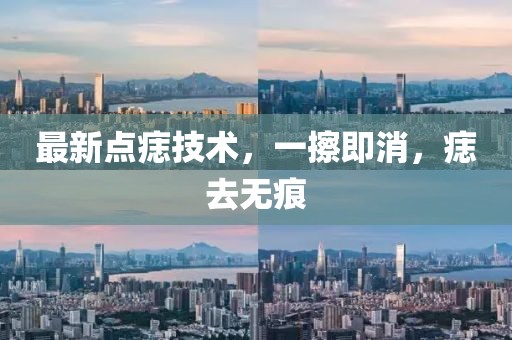 最新點痣技術(shù)，一擦即消，痣去無痕